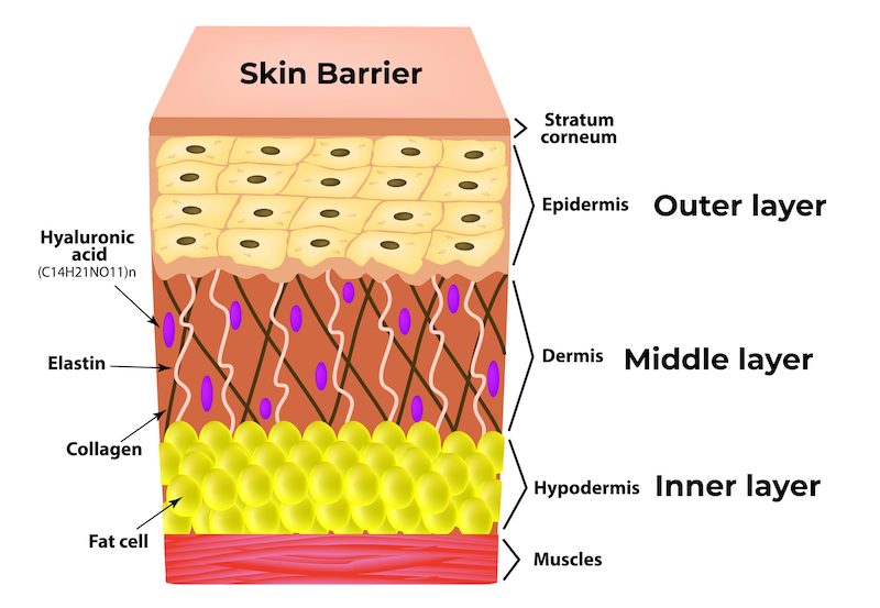 The Skin Barrier