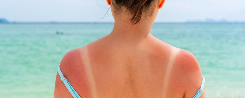 sun damaged skin treatment